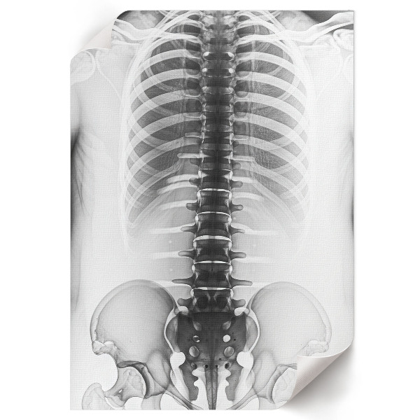 Poster na stenu Röntgen
