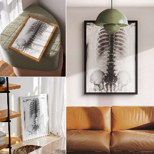 Poster na stenu Röntgen