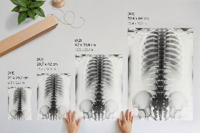 Poster na stenu Röntgen